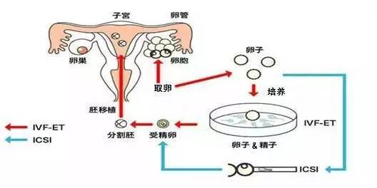 43岁借卵试管婴儿成功率